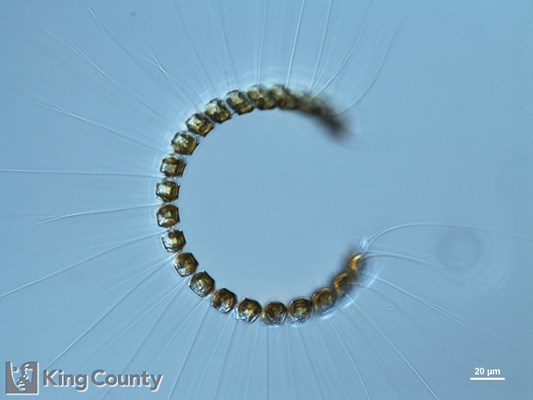 Photo of Chaetoceros debilis